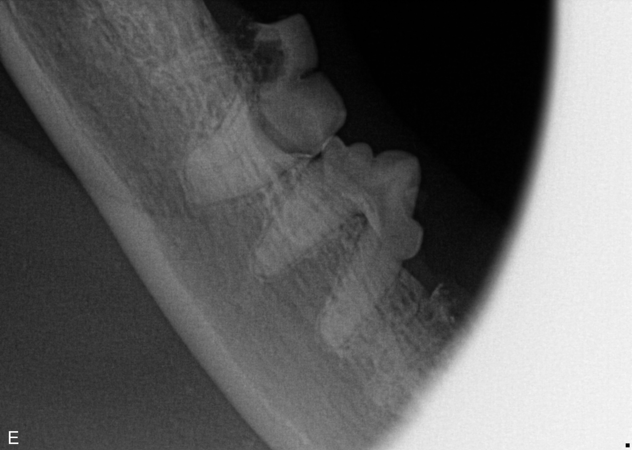 Not All Dentals Are Equal